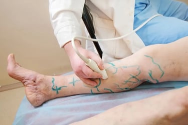 vascular ultrasound venous skin marking varicose veins surgery pre operative mapping vein skin imaging leg swelling treatment