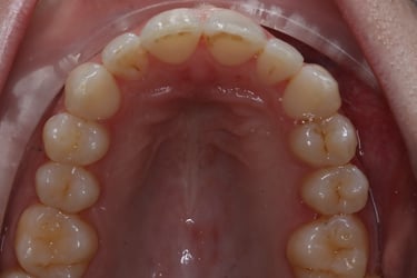 pictures of teeth