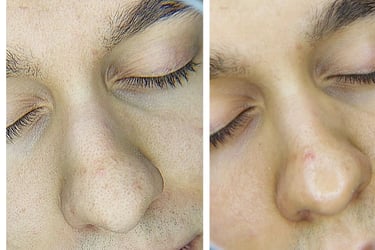 Férfi arckezelés Veszprém