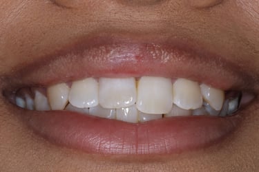 pictures of teeth