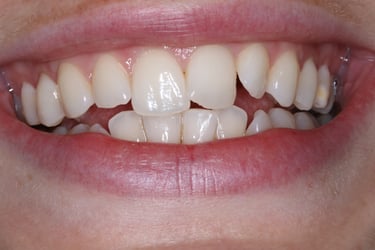 pictures of teeth