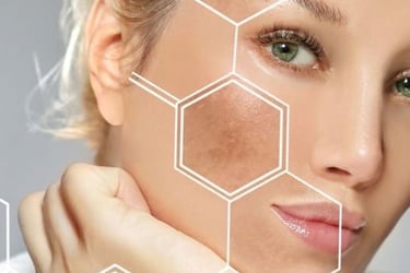 Limpieza facial, peeling antimanchas, rejuvenecimiento de la piel en Barcelona, Lleida y Mataró.