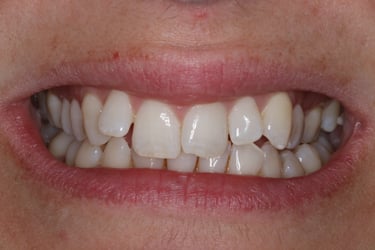 pictures of teeth