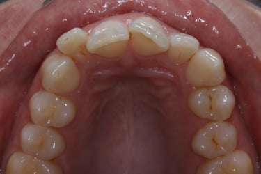 pictures of teeth