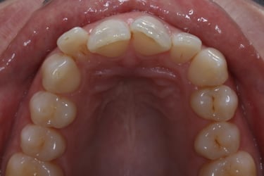 pictures of teeth