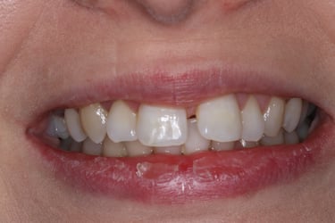 pictures of teeth