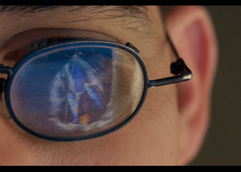 Reflection in eyeglasses of a cardiac ultrasound scan showing valve regurgitation.