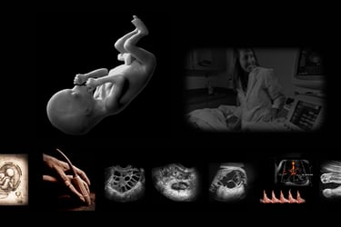 Image of a human fetus and various obstetric ultrasound images with and without Doppler.