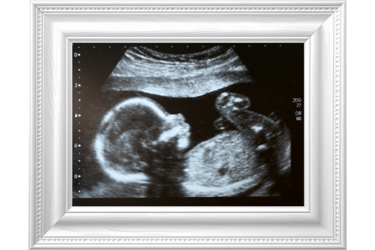Ultrasound of baby in white frame