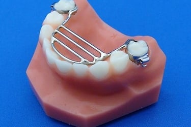 a image showing crib thumb sucking appliance