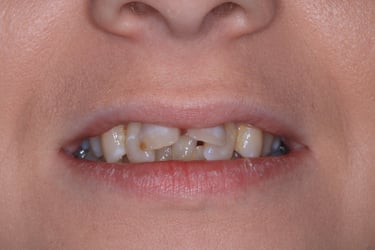 pictures of teeth