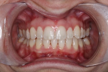 pictures of teeth