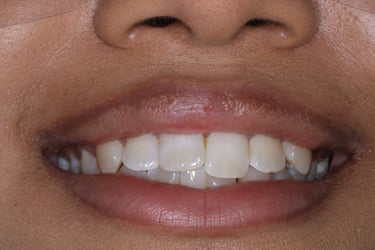 pictures of teeth