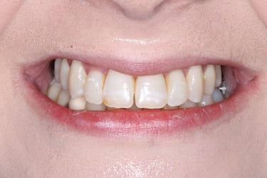 pictures of teeth