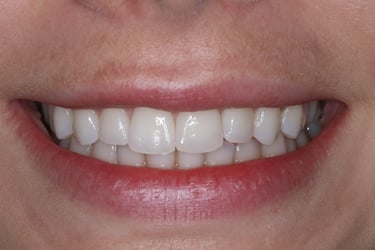 pictures of teeth