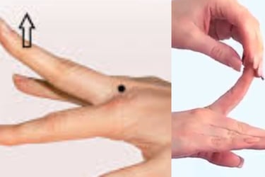 🤲 Trigger Finger & the Role of Voluntary Fasting: A Natural Healing Approach