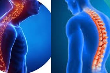 🦴❄️ Kyphosis and Kyphoscoliosis The Only Hope – Cold Water & Fasting Therapy 🍽️💧