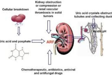 Fasting and Tumor Lysis Syndrome