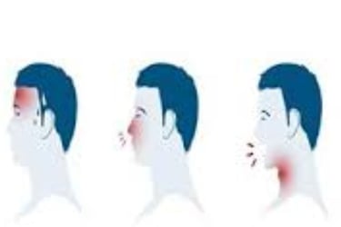 صداع التهاب بالانف كحة اعراض