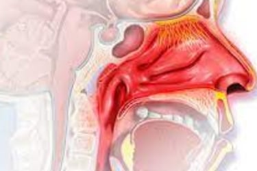 Honey The only Remedies for Posterior Nasal Bleeding