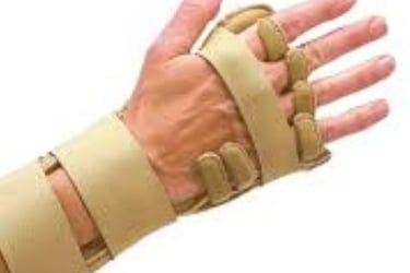 Rheumatoid Arthritis splint