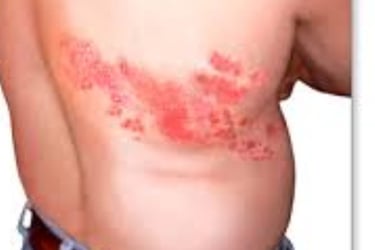 https://www.h-k-e-m.com/belt-of-fire-shingles-strange-management