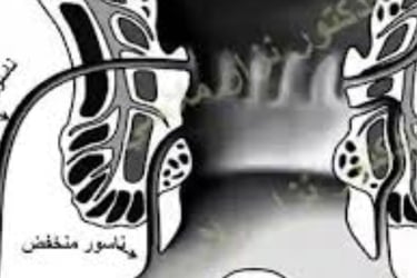 الشرخ و الناسور الشرجي