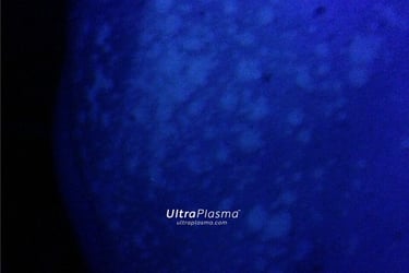 ma_ultra_plazma_examin-ng_skin_cilt_analiz_disorder_analysis_dermatologist