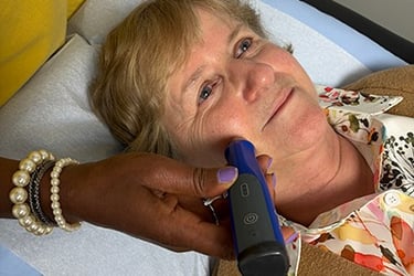 older woman laying on a doctors table receiving microneedling treatment