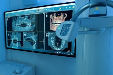 Dental 3D Ct Scan