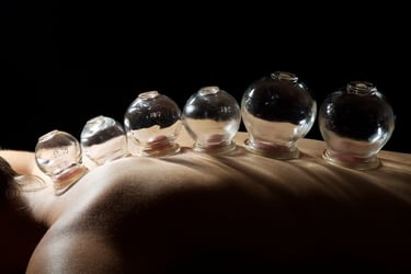 cupping in acupuncture clinic