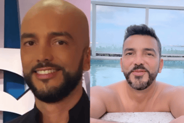 hombre calvo y hombre con cabello