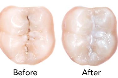 sealants