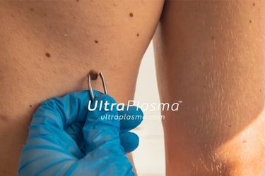 ma_ultra_plazma_examin-ng_skin_cilt_analiz_disorder_analysis_dermatologist