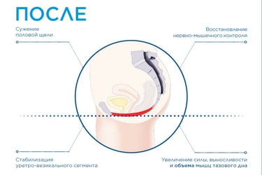 фото після процедури