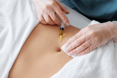 Mesoterapia com agulha