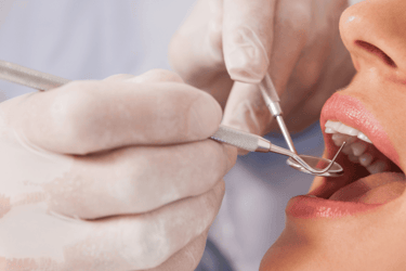 clear braces consultation