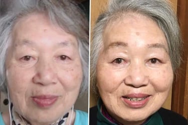 Before and after of woman aging younger