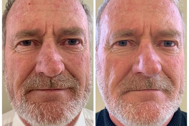 Before and after of man aging younger