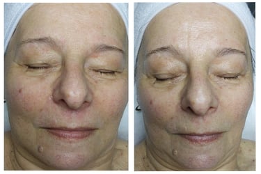 Neuro Cannabis kezelés Veszprém