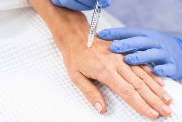 Hand rejuvenation treatments with boosters and fillers
