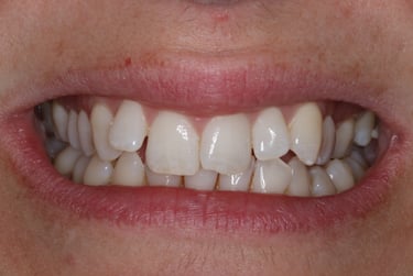pictures of teeth