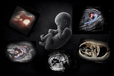Montage of OB ultrasound images showing the findings in early, mid, and late-term pregnancy.