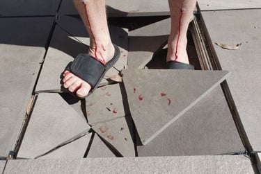 Injury caused by pedestal tile breaking