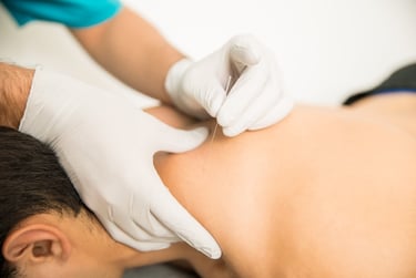 acupuntura, puntología, punción seca