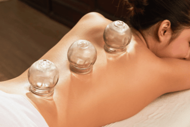 Schröpfen in der Physiotherapie Nürnberg Stresemannplatz zur Förderung der Durchblutung und Muskelen