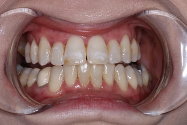 pictures of teeth
