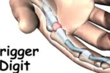 🤲 Trigger Finger & the Role of Voluntary Fasting: A Natural Healing Approach