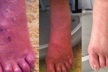 skin chages