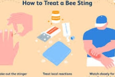 Bee Therapy the Benefits and Uses of Bee Venom (4)